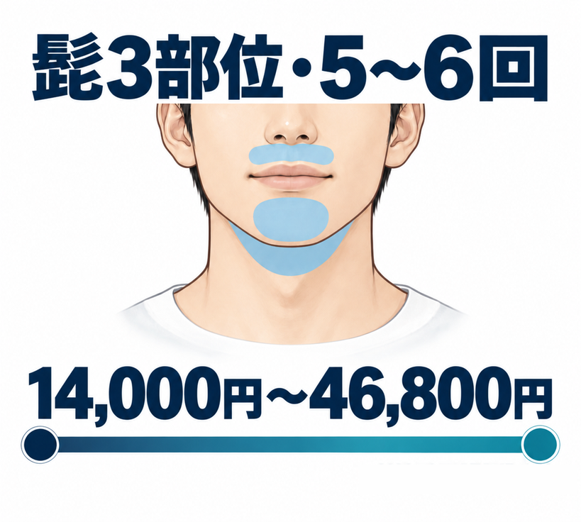 髭のレーザー脱毛 値段5〜6回