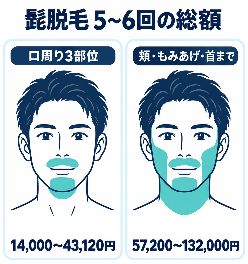髭脱毛 ５〜6回 総額
